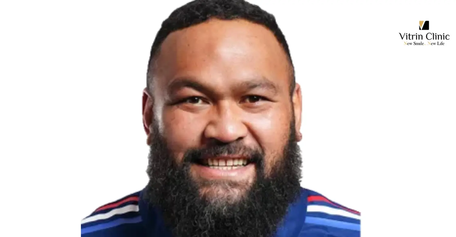 Comment l’évolution dentaire influence-t-elle son sourire ?